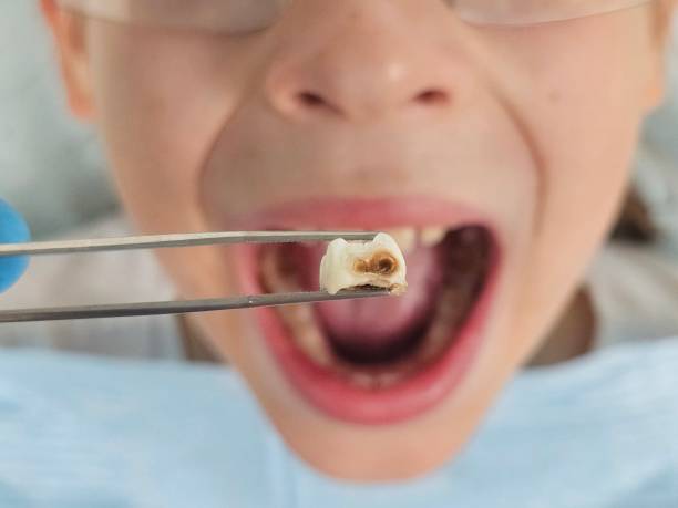 Best Weekend Emergency Dentist in Johnson City, KS