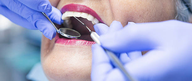 Best Emergency Root Canal Treatment in Johnson City, KS